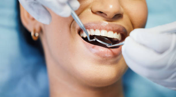 Best Knocked-Out Tooth (Avulsed Tooth) Treatment in Piperton, TN